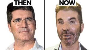 What happened to Simon Cowell's age 64 years old? It so sad! has he has been confirmed to be...see more 